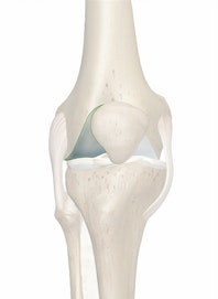 Lateral Condyle of Femur