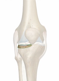 Lateral Condyle of Tibia