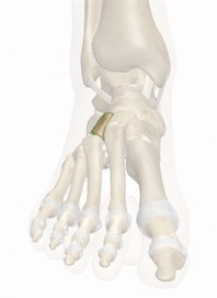 Lateral Cuneiform Bone