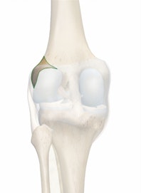 Lateral Epicondyle of Femur