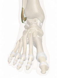 Lateral Malleolus