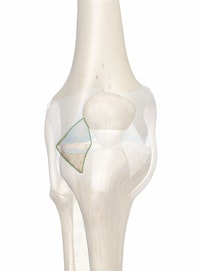 Lateral Patellar Retinaculum