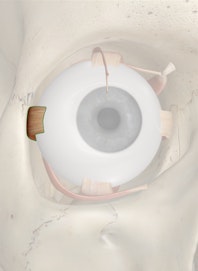 Lateral Rectus Muscle