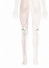 Lateral Superior Genicular Artery