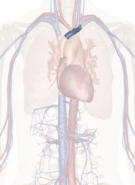 Left Brachiocephalic Vein