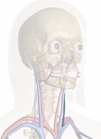 Left External Jugular Vein