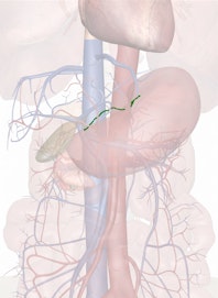 Left Gastric Vein