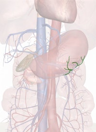 Left Gastroepiploic Artery