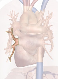 Left Inferior Pulmonary Vein