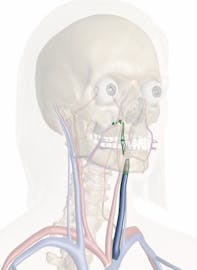 Left Internal Jugular Vein