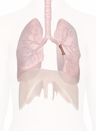 Left Lower Lobe Bronchus (Secondary)