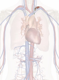 Left Subclavian Artery