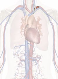 Left Subclavian Artery