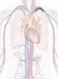 Left Subclavian Vein