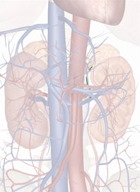 Left Suprarenal Vein