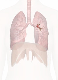 Left Upper Lobe Bronchus (Secondary)