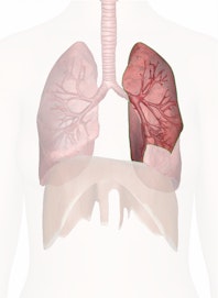 Left Upper Lobe of Lung