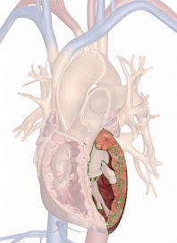 The Left Ventricle