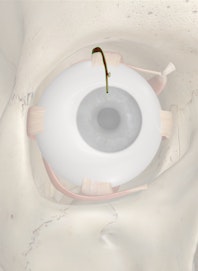 Levator Palpebrae Superioris Muscle