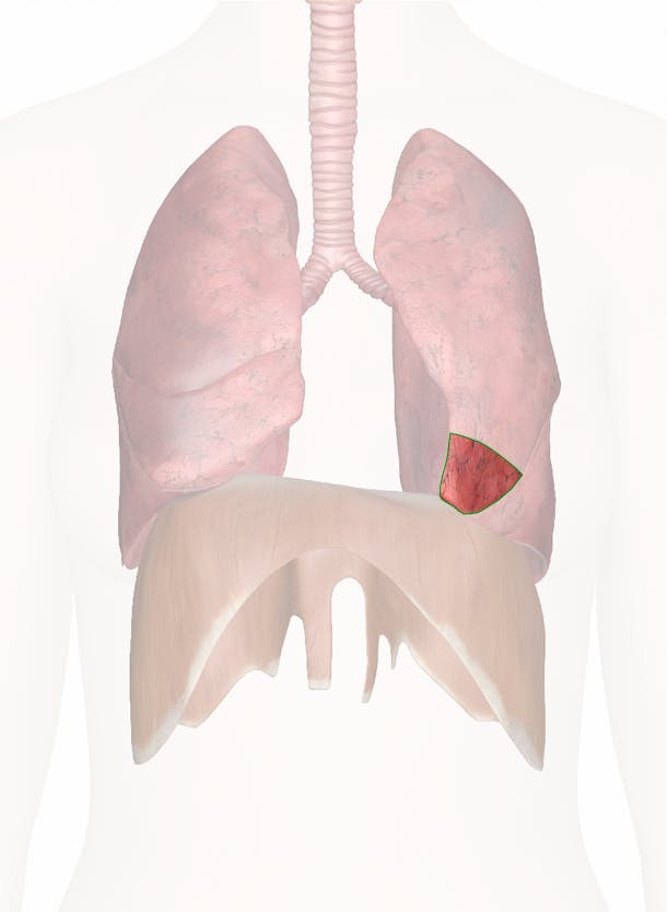 lingula lung