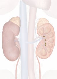 Major Calyx of Kidney