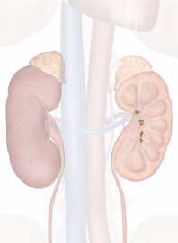Major Calyx of Kidney