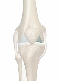Medial Condyle of Femur