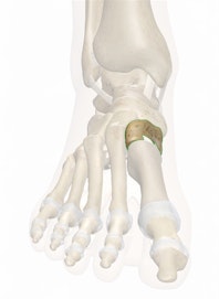 Medial Cuneiform Bone