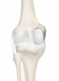 Medial Epicondyle of Femur