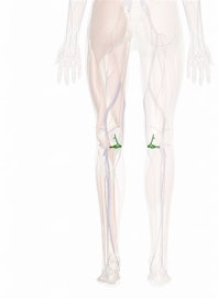 Medial Inferior Genicular Artery