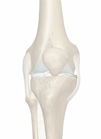 Medial Meniscus