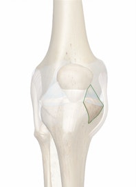 The Medial Patellar Retinaculum