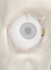 Medial Rectus Muscle