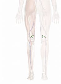 Medial Superior Genicular Artery