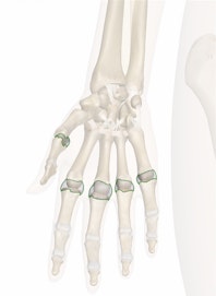 Metacarpophalangeal (MCP) Joints