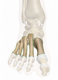Metatarsal Bones