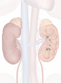 Minor Calyx of Kidney