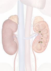 Minor Calyx of Kidney