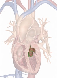 Mitral Valve
