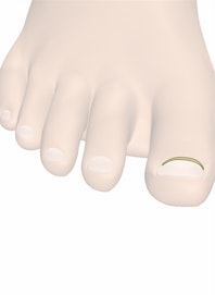 Nail Root of Toenail