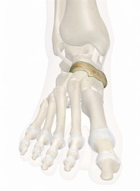 Navicular Bone
