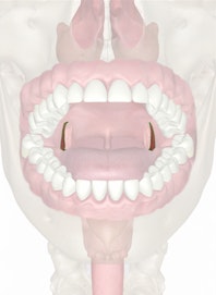 Palatoglossal Arch and Palatoglossus Muscle