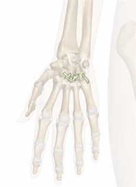 Palmar Carpometacarpal Ligaments
