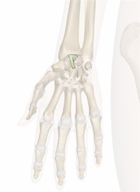 Palmar Radiocarpal Ligament