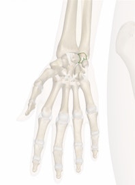 Palmar Ulnocarpal Ligament