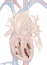 Papillary Muscles