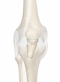 Patellar Ligament