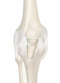 Patellar Ligament