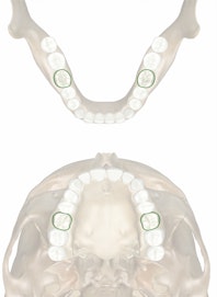 Permanent 1st Molar 6th Yr