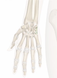 Pisometacarpal Ligament